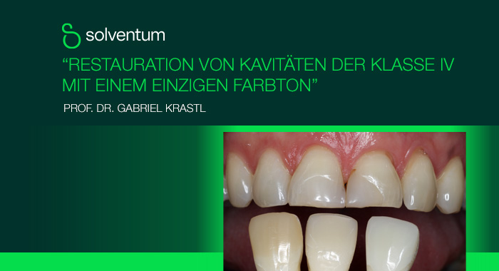 Solventum-klinische-Studie2-Krastl-700x380